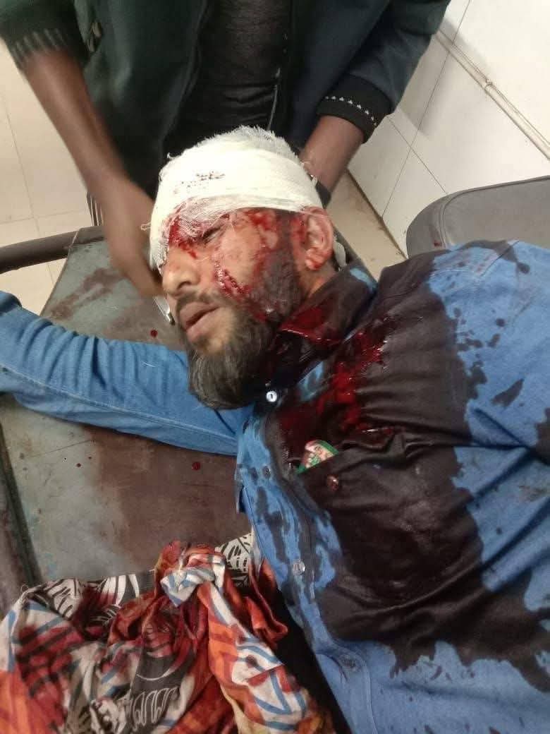 খুলনায় দিনে দুপুরে এনসিপি নেতাকে মাথায় গুলি